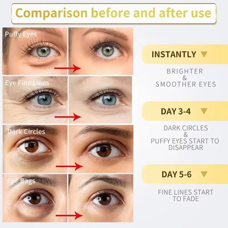 Instant Eye Bag Removal Cream Retinol