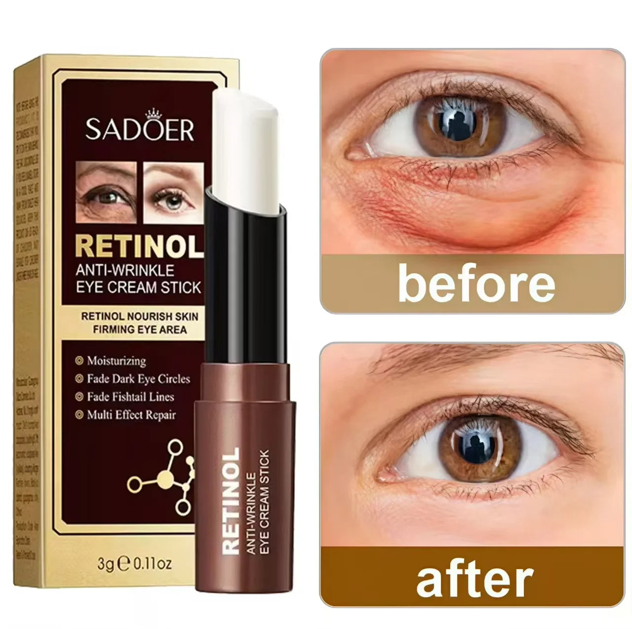 Instant Eye Bag Removal Cream Retinol
